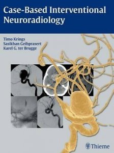Case-based Interventional Neuroradiology
