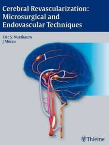 Cerebral Revascularization: Microsurgical and Endovascular Techniques