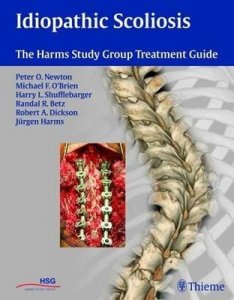 Idiopathic Scoliosis