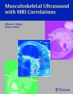 Musculoskeletal Ultrasound with MRI Correlations