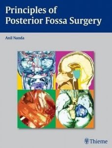 Principles of Posterior Fossa Surgery: Surgical Management