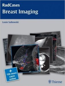 Rad Cases Breast Imaging