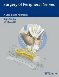 Surgery of Peripheral Nerves
