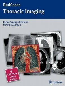 Thoracic Imaging