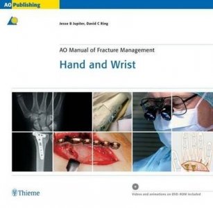 AO Manual of Fracture Management