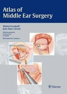 Atlas of Middle Ear Surgery