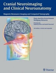 Cranial Neuroimaging and Clinical Neuroanatomy