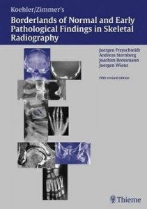 Koehler/Zimmer's Borderlands of Normal and Early Pathological Findings in Skeletal Radiography