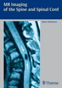 Mr Imaging of the Spine and Spinal Cord