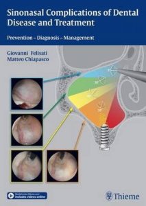 Sinonasal Complications of Dental Disease and Treatment