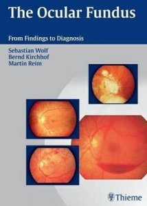 The Ocular Fundus