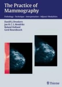 The Practice of Mammography