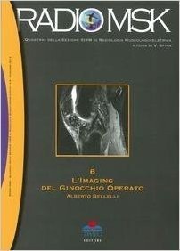 L' imaging del ginocchio operato