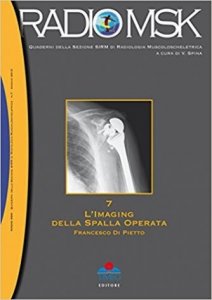 L' imaging della spalla operata