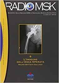 L' imaging dell'anca operata