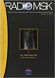 Le Osteolisi