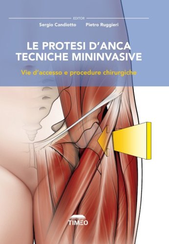 Le protesi d'anca. Tecniche mininvasive. Vie d'accesso e procedure chirurgiche