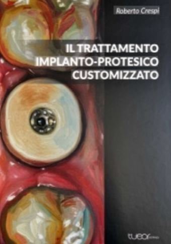 Il trattamento implanto-protesico customizzato