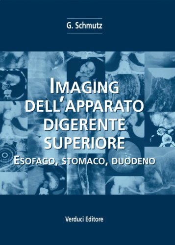 Imaging dell'apparato digerente superiore. Esofago, stomaco, duodeno