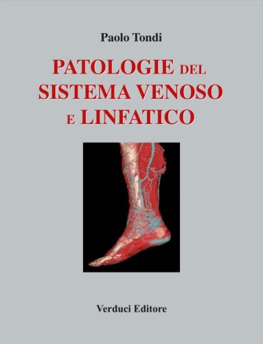 Patologie del sistema venoso e linfatico