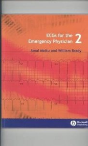 ECGs for the Emergency Physician