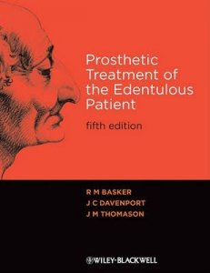 Prosthetic Treatment of the Edentulous Patient