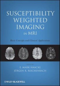 Susceptibility Weighted Imaging in MRI