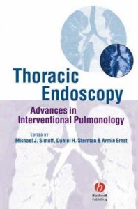 Thoracic Endoscopy