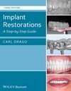 IMPLANT RESTORATIONS