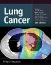 LUNG CANCER