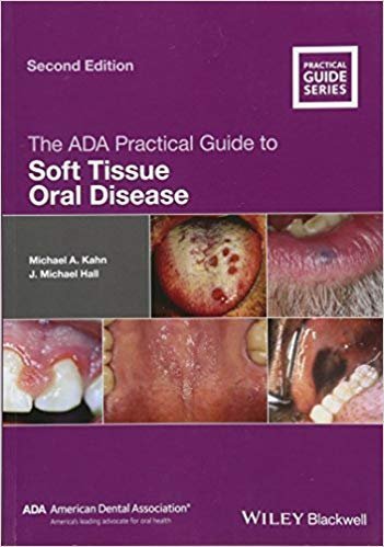 The ADA Practical Guide to Soft Tissue Oral Disease