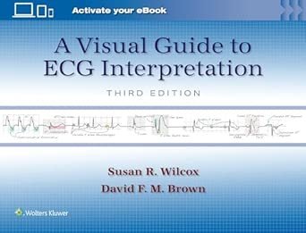 A Visual Guide to ECG Interpretation: Print + eBook with Multimedia