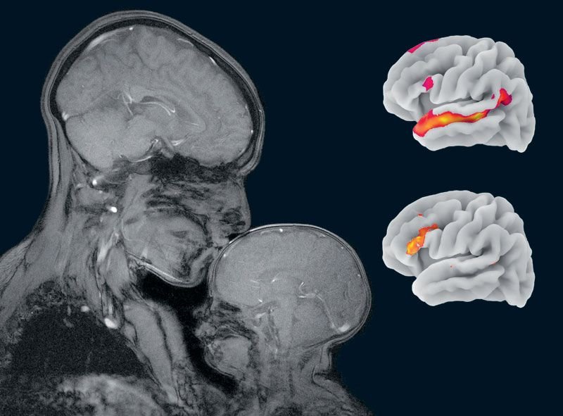 Vedere la mente. Il cervello in 100 immagini | 2