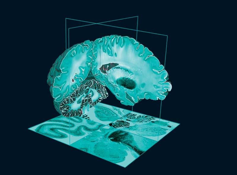 Vedere la mente. Il cervello in 100 immagini | 3
