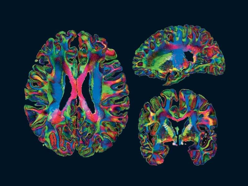 Vedere la mente. Il cervello in 100 immagini | 4