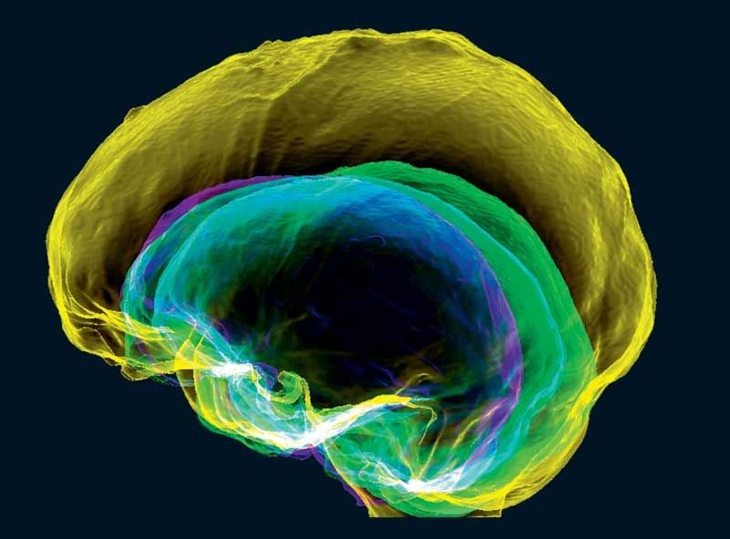 Vedere la mente. Il cervello in 100 immagini | 5
